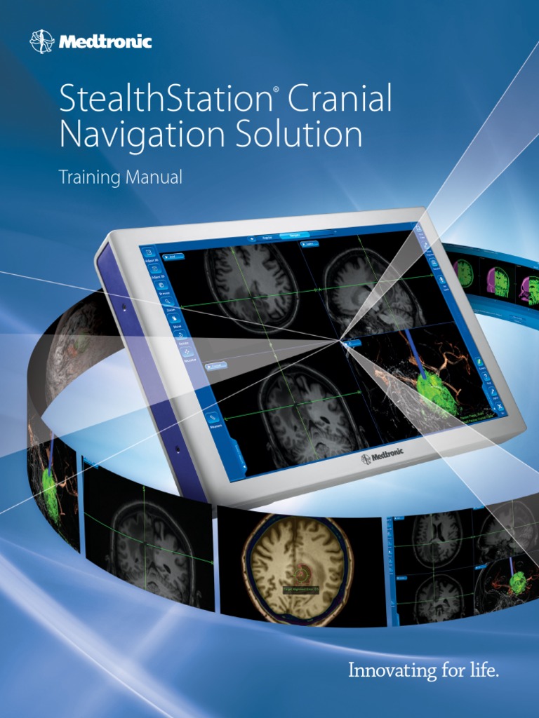 SOFTWARE 9733763 SYNERGY CRANIAL S7