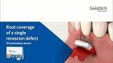 PROG CT900D CLINICIAN TABLET GLOBAL