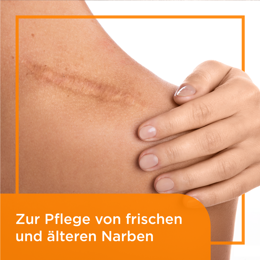 BEPANTHEN DERMA Narben-Gel Tb 20 g