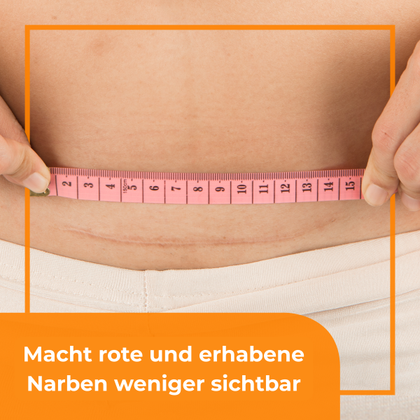 BEPANTHEN DERMA Narben-Gel Tb 20 g