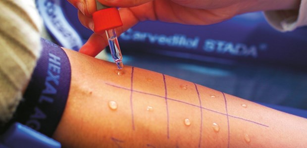 Prick-Test Lac vaccinum, Pricktestlösung