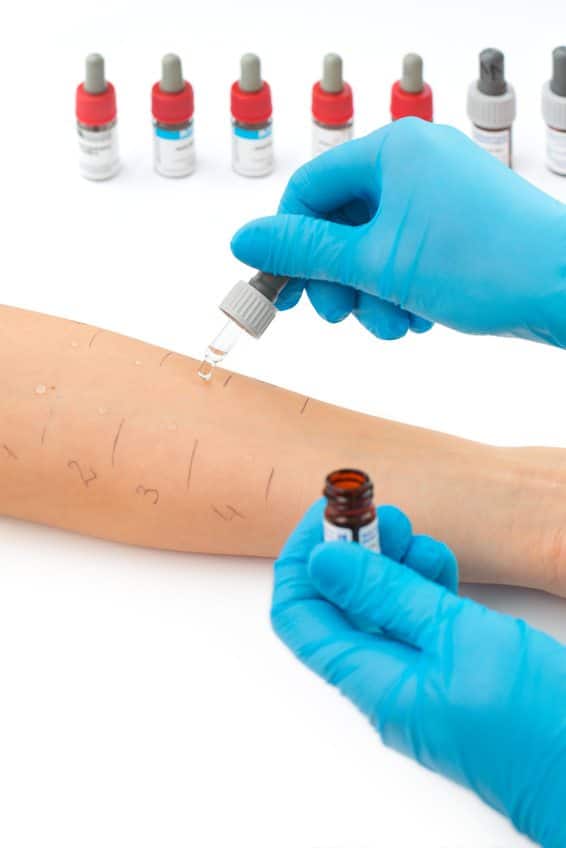 Prick-Test Sus scrofa domestica, Pricktestlösung