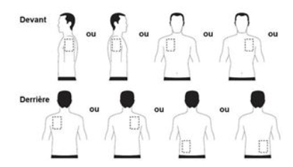 RIVASTIGMIN Patch Sandoz 5 4.6 mg/24h 30 pce