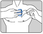 RIVASTIGMIN Mepha Patch 13.3 mg/24h TTS 60 pce