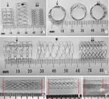 Formula 535 Vascular Balloon-expandable Stent, 1 Each