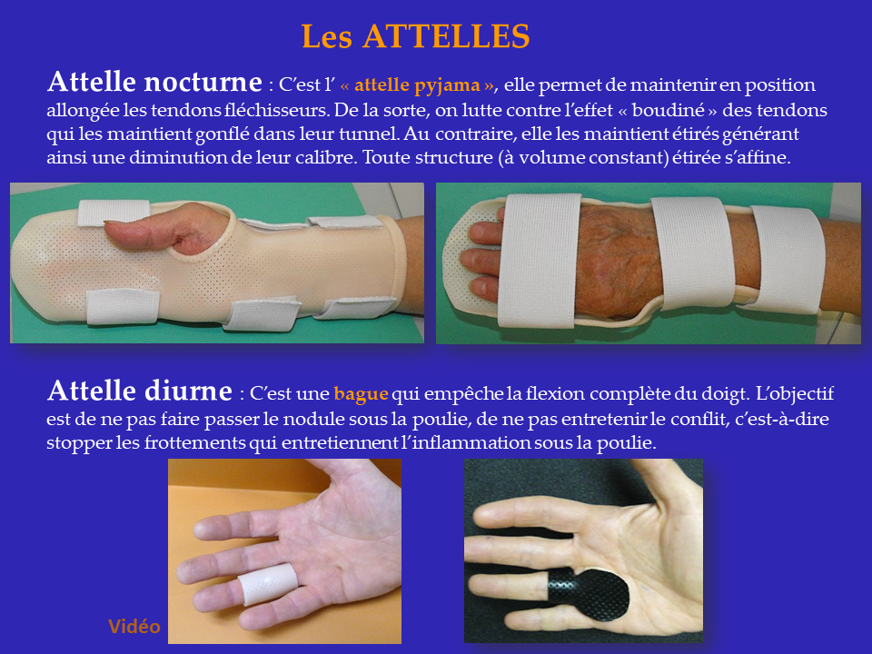 Finger Splint