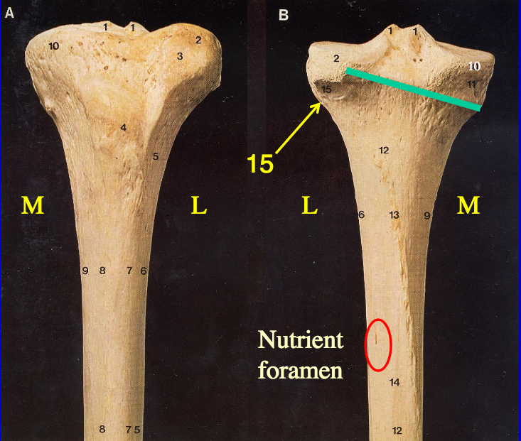 Predriver for Proximal Tibia