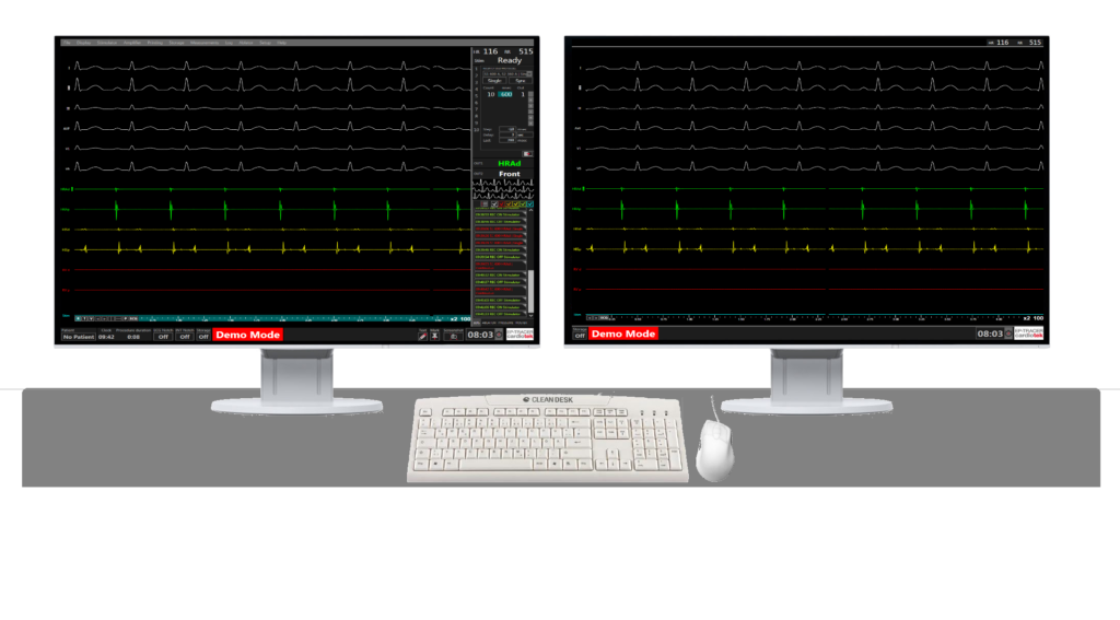 STATIONARY MONITORS MDT18 EP-TRACER 70