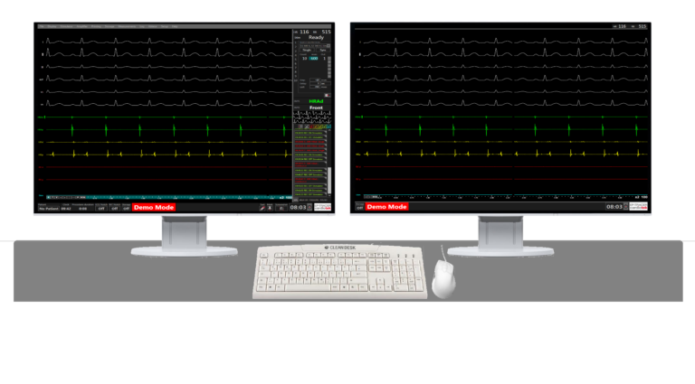 STATIONARY MONITORS MDT19 EP-TRACER 70