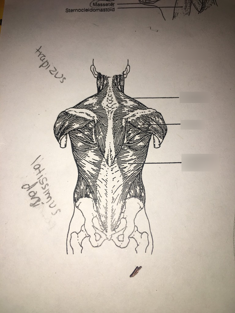 POSTERIOR BODY RESECTOR 7480511 15MM