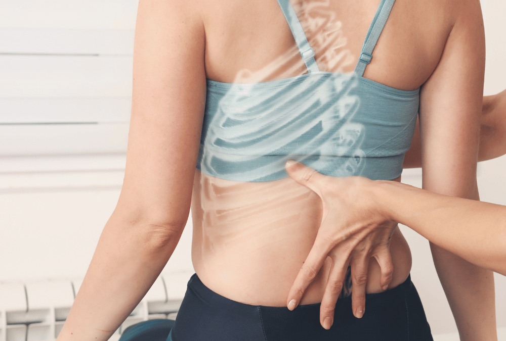 RACK 5580116 LORDOSIS