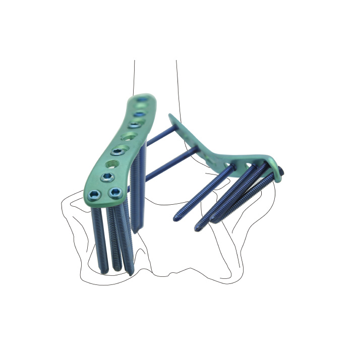 PLATE 015-236 Y 3H X 3H 2.5MM DOUBLE