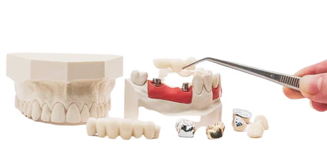 PROSTHESIS 1156623 BIG EASY PISTON RT OF
