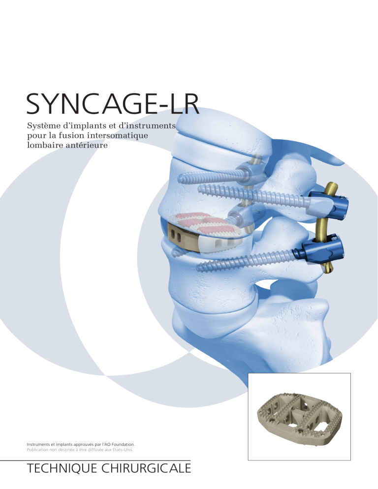 SYNCAGE XXS 12X24X30