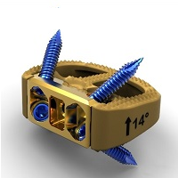 SYNFIX EVOLUTION REMOVAL TOOL