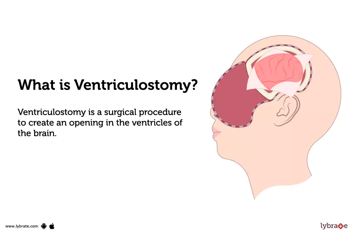 RES 44210 VENTRICULOSTOMY BH 6MM SHW IMP