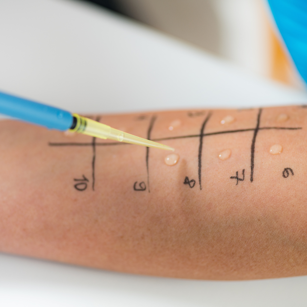 Prick-Test Lolium perenne, Pricktestlösung