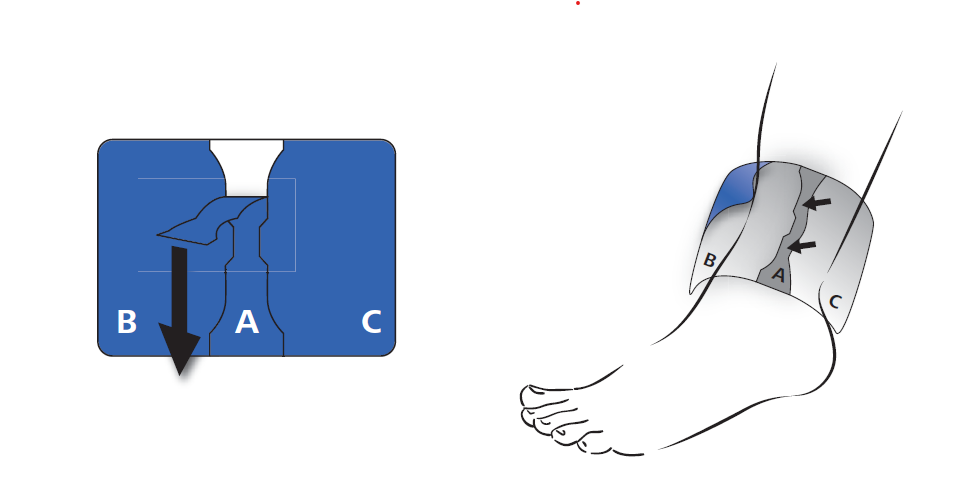 Lixim Patch, wirkstoffhaltiges Pflaster